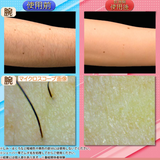 ReFa EPI GO 全身対応 美肌効果 脱毛 光美容器