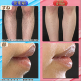 ReFa EPI GO 全身対応 美肌効果 脱毛 光美容器