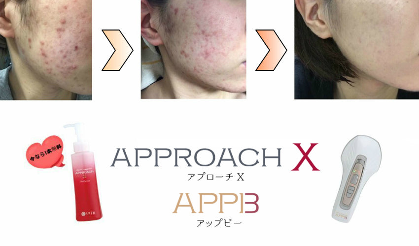 APPB（アップビー）  APPROACH x（アプローチ エックス） Amazon.co.jp: セプテム アプローチX ビーエム セラム 120ml