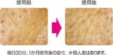 日本製(MADE IN JAPAN)磁力童顏機 乾燥細紋對策 專門皮膚科醫生開發 (100V)